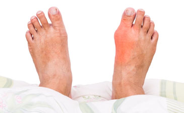 arthritis treatment in Delhi